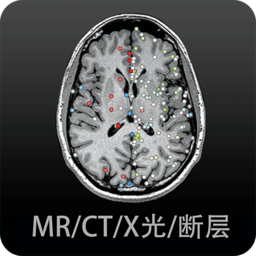 影像解剖图谱app下载-影像解剖图谱软件下载v4.1.9 安卓版