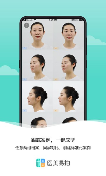 医美易拍app下载-医美易拍软件下载v2.0.3安卓版&苹果版_健康医疗_36397绿色下载网