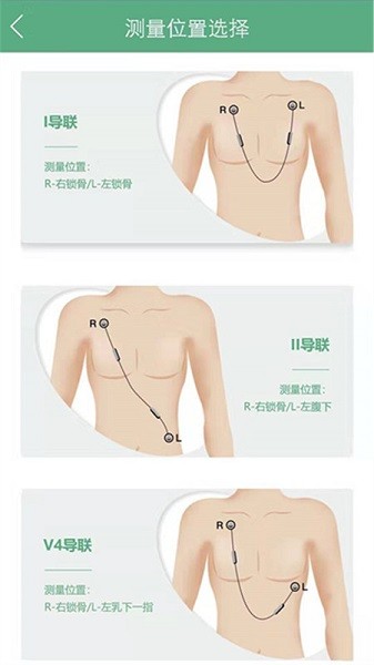 未然之光心眼app下载-未然之光心眼软件下载v1.4.19安卓版&苹果版_健康医疗_36397绿色下载网