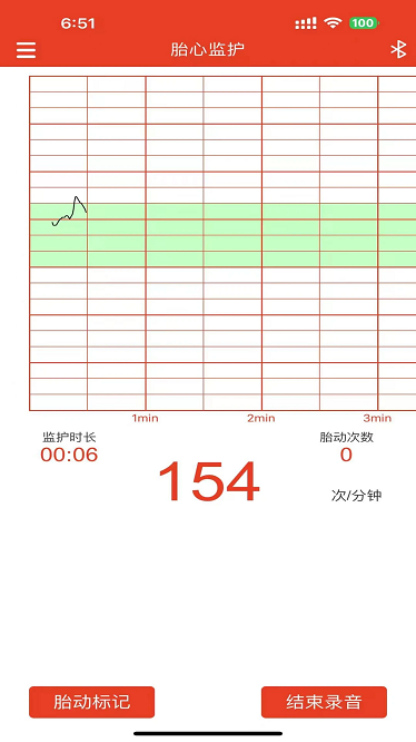 左点胎心仪最新版下载-左点胎心仪app下载v1.7安卓版&苹果版_健康医疗_36397绿色下载网